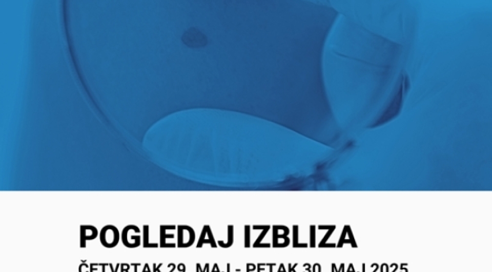 Dođite na besplatni pregled madeža u Dom zdravlja Vareš